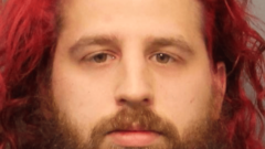 Police: Auburn man arrested for biting girlfriend